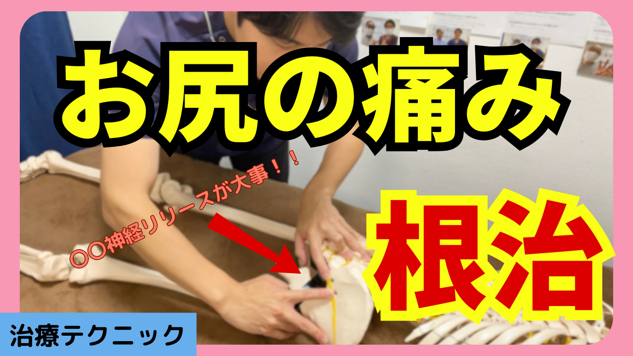 立ちっぱなしによるお尻の痛みを改善させる〇〇神経リリーステクニックについて解説！！